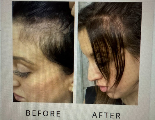 What is the Best Thing to Stimulate Hair Growth?
